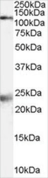 Anti-NMDA Receptor 1/GRIN1 antibody produced in goat affinity isolated antibody, buffered aqueous solution