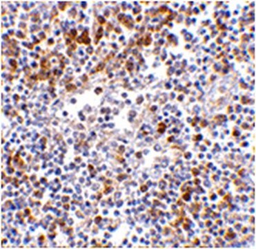 Anti-MDA5 Antibody from rabbit, purified by affinity chromatography