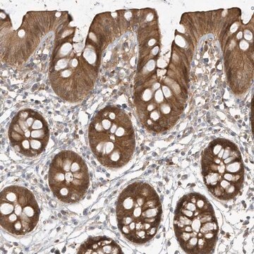 Anti-HNMT antibody produced in rabbit Prestige Antibodies&#174; Powered by Atlas Antibodies, affinity isolated antibody, buffered aqueous glycerol solution