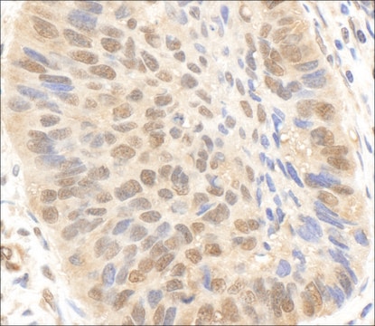 Rabbit anti-p300 Antibody, Affinity Purified Powered by Bethyl Laboratories, Inc.