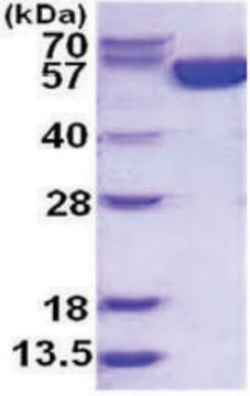 G6PD human recombinant, expressed in E. coli, &#8805;95% (SDS-PAGE)