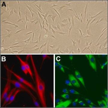 Human Dermal Fibroblasts: HDF, adult