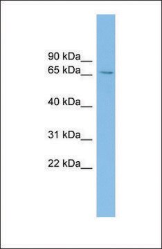 Anti-SLC6A1 antibody produced in rabbit affinity isolated antibody