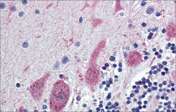 Anti-ST18 affinity isolated antibody