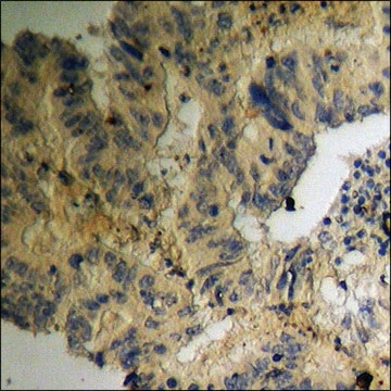 Anti-phospho-Kv1.3/KCNA3 (pTyr135) antibody produced in rabbit affinity isolated antibody