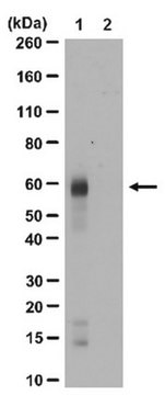 Anti-acetyl-c-Myc (Lys148) Antibody from rabbit, purified by affinity chromatography