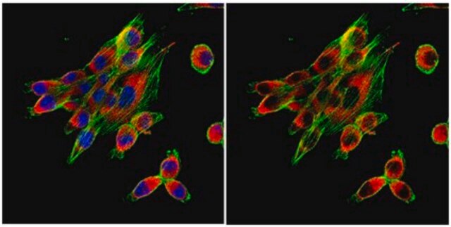 Anti-Calnexin Antibody from rabbit, purified by affinity chromatography