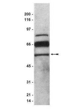 Anti-PEDF Antibody Upstate&#174;, from rabbit