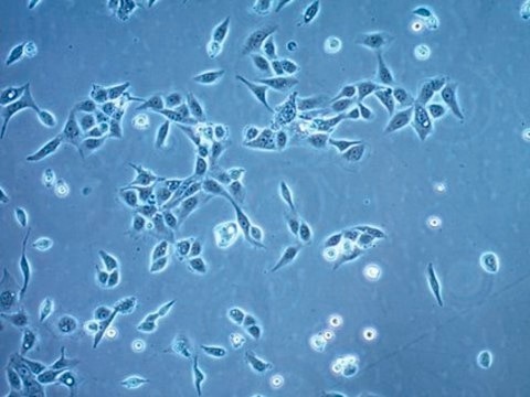 OECM-1 Human Oral Squamous Carcinoma Cell Line OECM-1 human oral squamous carcinoma cell line is suitable for studies of cancer cell signaling, epithelial-mesenchymal transition (EMT), metastasis, invasion, and cancer cell stemness.