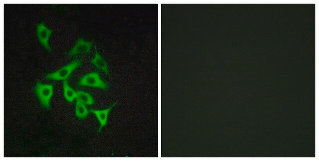 Anti-GPR100 antibody produced in rabbit affinity isolated antibody