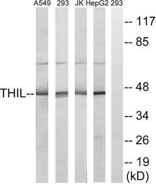 Anti-ACAT1 antibody produced in rabbit affinity isolated antibody