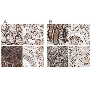 Anti-CHAMP1 antibody produced in rabbit Prestige Antibodies&#174; Powered by Atlas Antibodies, affinity isolated antibody, buffered aqueous glycerol solution