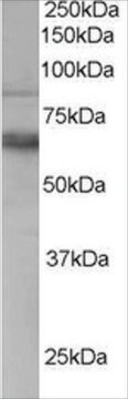 Anti-TEM8/Anthrax Toxin Receptor 1 antibody produced in goat affinity isolated antibody, buffered aqueous solution