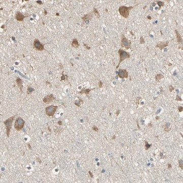 Anti-ACSL4 antibody produced in rabbit Prestige Antibodies&#174; Powered by Atlas Antibodies, affinity isolated antibody, buffered aqueous glycerol solution