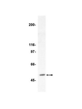 Anti-HDAC3 Antibody Upstate&#174;, from rabbit