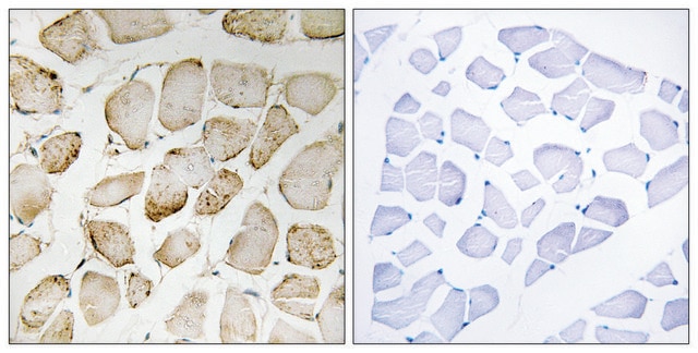 Anti-Arachidonate 5 Lipoxygenase antibody produced in rabbit affinity isolated antibody