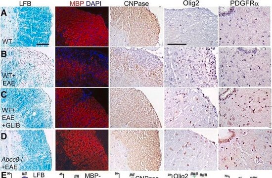 Anti-Olig2 Antibody, clone 211F1.1 clone 211F1.1, from mouse