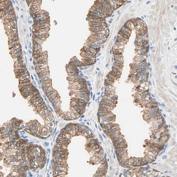 Anti-ATF6 antibody produced in rabbit Prestige Antibodies&#174; Powered by Atlas Antibodies, affinity isolated antibody, buffered aqueous glycerol solution