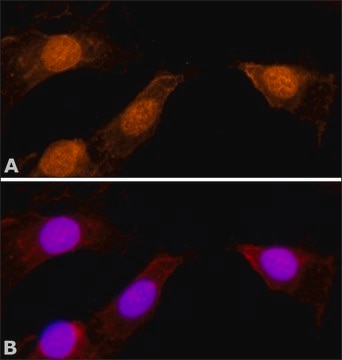 Anti-Myosin I&#946; (Nuclear) antibody produced in rabbit affinity isolated antibody, buffered aqueous solution