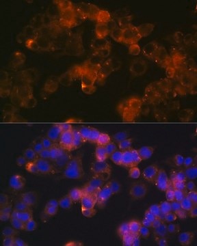 Anti-Sonic Hedgehog (Shh) antibody produced in rabbit