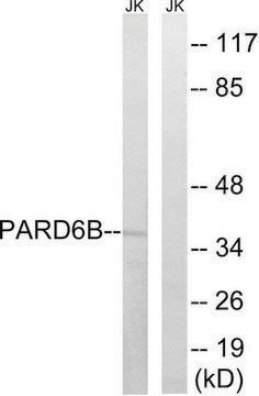 Anti-PARD6B antibody produced in rabbit affinity isolated antibody