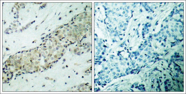 Anti-HDAC5 (Ab-498) antibody produced in rabbit affinity isolated antibody