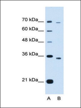 Anti-PHF6 (AB1) antibody produced in rabbit IgG fraction of antiserum