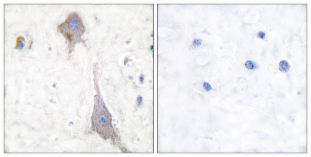 Anti-MGLUR7 antibody produced in rabbit affinity isolated antibody