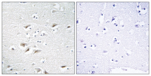 Anti-ZEB2 antibody produced in rabbit affinity isolated antibody