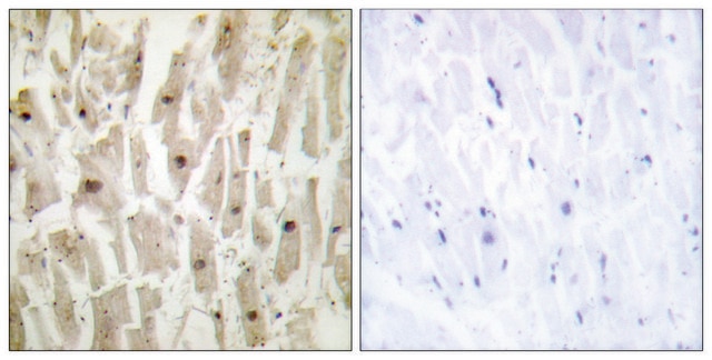 Anti-TSH1 antibody produced in rabbit affinity isolated antibody