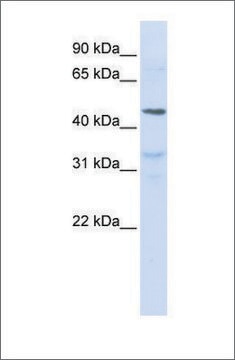 Anti-IL28RA antibody produced in rabbit affinity isolated antibody