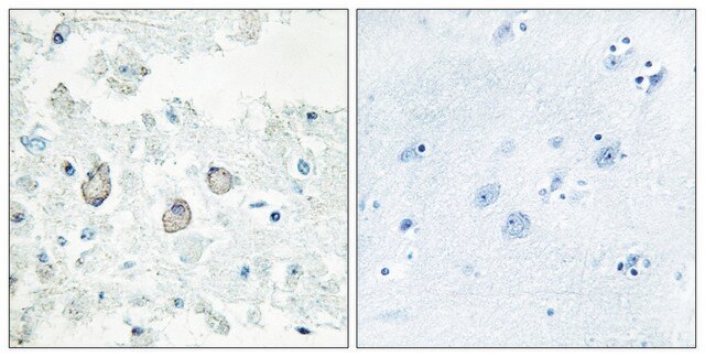 Anti-DOK7 antibody produced in rabbit affinity isolated antibody