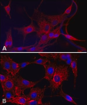 Anti-Superoxide Dismutase (MnSOD) (KC-19) antibody produced in rabbit IgG fraction of antiserum, buffered aqueous solution