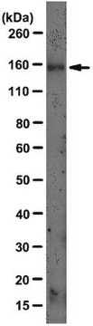 Anti-LDLR Antibody, clone C7 clone C7, from mouse