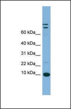 Anti-TFF1 antibody produced in rabbit affinity isolated antibody