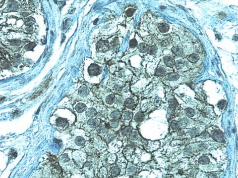 Anti-ZO-1 Antibody from rabbit, purified by affinity chromatography