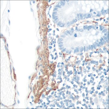 Anti-SMA antibody, Rabbit monoclonal clone SP171, recombinant, expressed in proprietary host, affinity isolated antibody