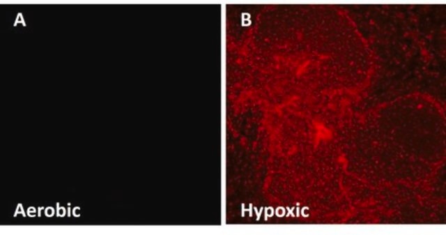 Anti-EF5 Antibody, clone ELK3-51 Antibody, Cyanine 5 conjugate clone ELK3-51, from mouse, CY5 conjugate