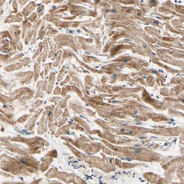 Anti-PDK2 antibody produced in rabbit Prestige Antibodies&#174; Powered by Atlas Antibodies, affinity isolated antibody, buffered aqueous glycerol solution