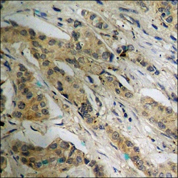 Anti-phospho-ATP-Citrate Lyase (pSer454) antibody produced in rabbit affinity isolated antibody