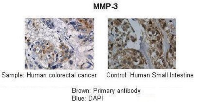 Anti-MMP3 antibody produced in rabbit affinity isolated antibody