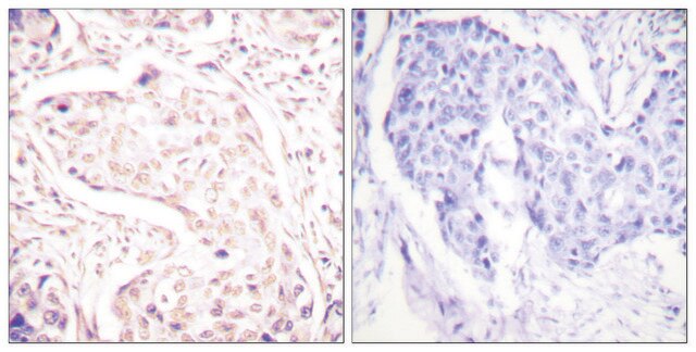 Anti-FOS antibody produced in rabbit affinity isolated antibody