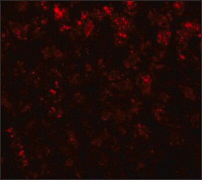 Anti-AFP antibody produced in rabbit affinity isolated antibody, buffered aqueous solution