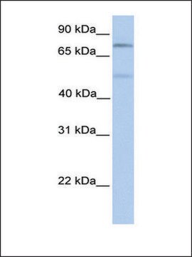 Anti-SP1 antibody produced in rabbit affinity isolated antibody