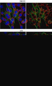 Anti-WASH complex subunit FAM21C Antibody from rabbit