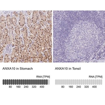 Anti-ANXA10 antibody produced in rabbit Prestige Antibodies&#174; Powered by Atlas Antibodies, affinity isolated antibody, buffered aqueous glycerol solution