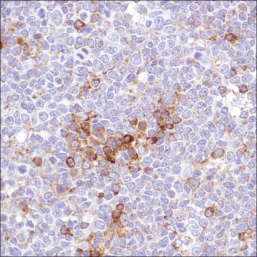 Anti-VPAC1 antibody, Rabbit monoclonal clone SP234, recombinant, expressed in proprietary host, affinity isolated antibody