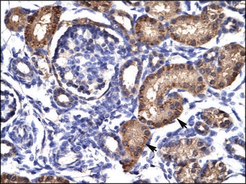 Anti-AHR IgG fraction of antiserum