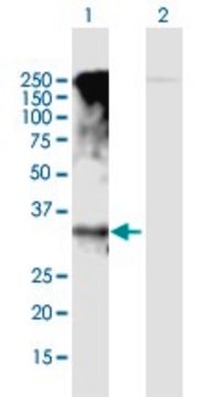 Anti-GPRC5D antibody produced in mouse purified immunoglobulin, buffered aqueous solution