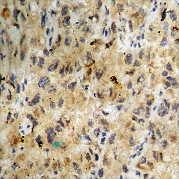 Anti-phospho-Casein Kinase II &#945; (pTyr255) antibody produced in rabbit affinity isolated antibody